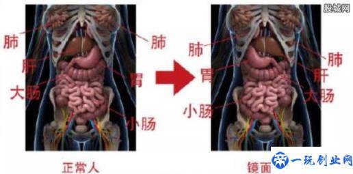 一女子五脏六腑全部反着长(一旦患病会带来巨大障碍)