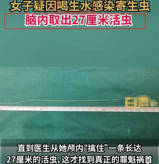 女子暴瘦20斤脑内取出27厘米活虫(喝生水会有寄生虫跑到脑子吗)