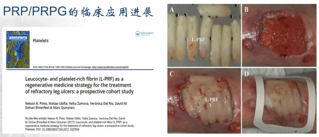 pdgf医学是什么意思(生长因子可以修复疤痕吗)