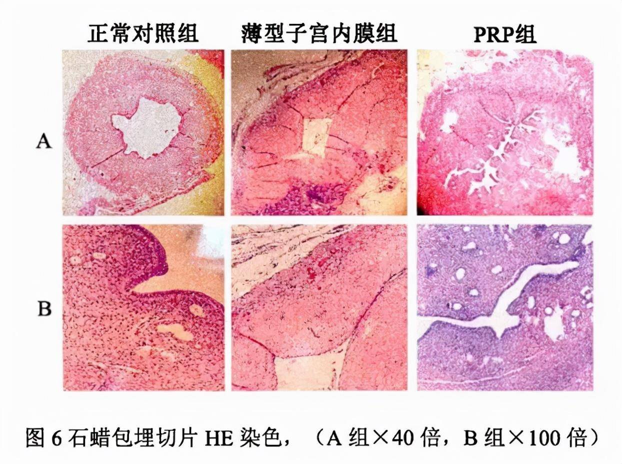 pdgf医学是什么意思(生长因子可以修复疤痕吗)