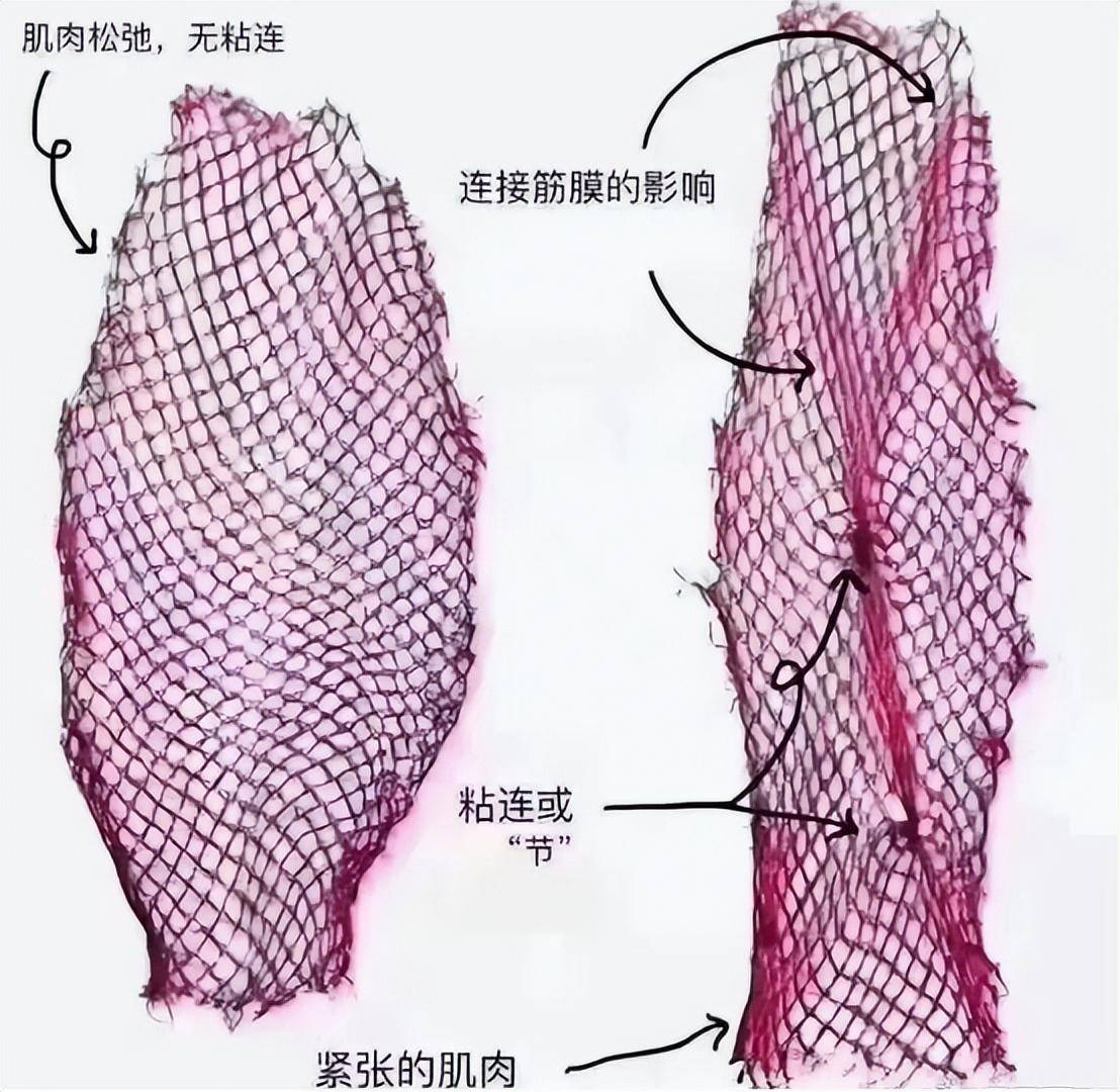 筋膜枪的正确用法演示(肌肉放松筋膜枪怎么用)